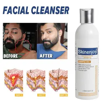 Skinenjoy που Λευκαίνει το του Προσώπου μέσο Καθαρισμού Φωτίζει τον Τόνο του Δέρματος Καθαρισμός Προσώπου Αφαίρεση Αναζωογόνηση Πλύσιμο Λεύκανση Chloasma Fade Ομαλή Y9Q7